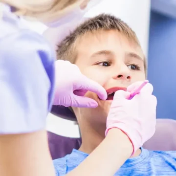 Tooth Extractions